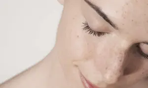 Primer plano de una mujer con pecas y marcas de **acné por estrés**. Sus ojos están cerrados, con pestañas largas y cejas definidas.