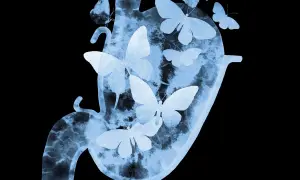 Silueta de un estómago con mariposas revoloteando en su interior, evocando la sensación de mariposas en el estómago.