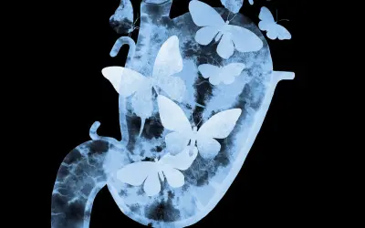 Silueta de un estómago con mariposas revoloteando en su interior, evocando la sensación de mariposas en el estómago.