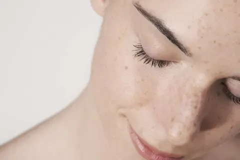Primer plano de una mujer con pecas y marcas de **acné por estrés**. Sus ojos están cerrados, con pestañas largas y cejas definidas.