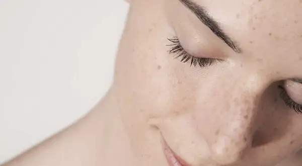Primer plano de una mujer con pecas y marcas de **acné por estrés**. Sus ojos están cerrados, con pestañas largas y cejas definidas.